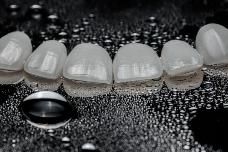 Natural looking ceramic veneers with good looking texture shade colors shape and translucent edge with the background and details