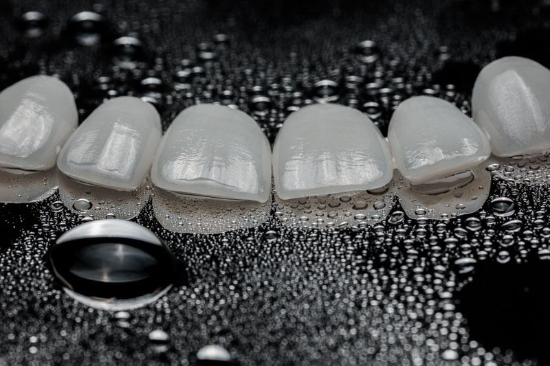 Natural looking ceramic veneers with good looking texture shade colors shape and translucent edge with the background and details
