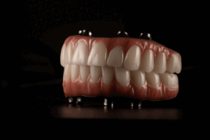 full-mouth-dental-implants-dentures-black-background
