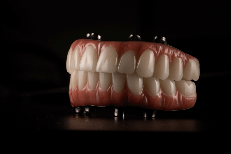 full-mouth-dental-implants-dentures-black-background