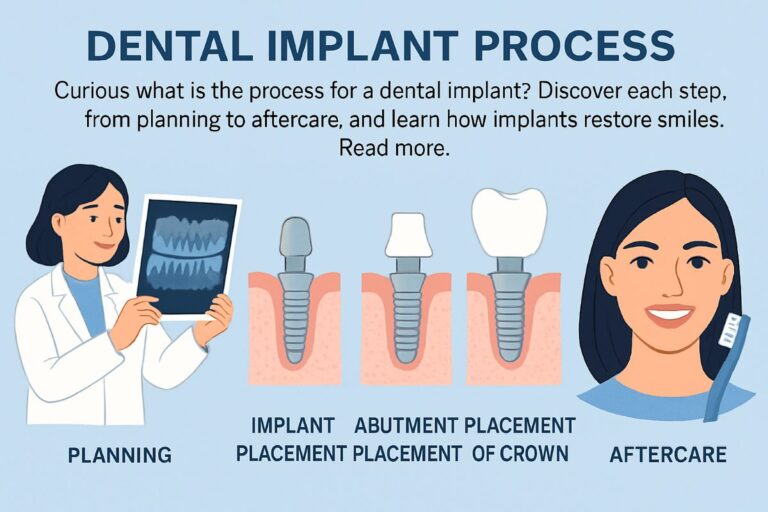 Image showcasing the dental implant process, from initial consultation to final crown placement. Include diverse patients and dental professionals. No text on image.